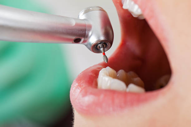 Best Emergency Root Canal Therapy in Mahanoy City, PA